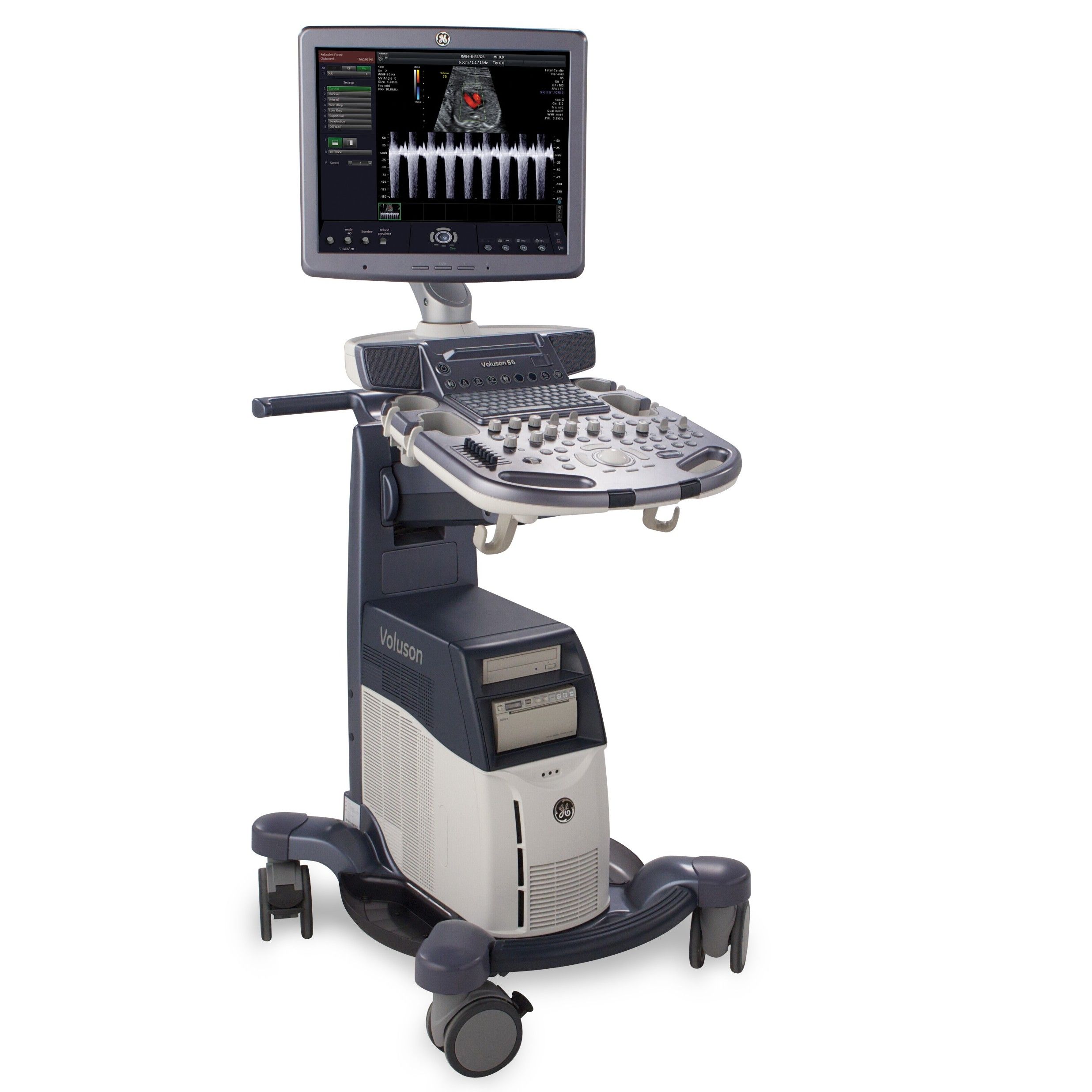 УЗИ аппарат GE Healthcare Voluson S6