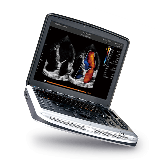 Ветеринарный УЗИ-аппарат CHISON SonoTouch 80 Sonobook 8