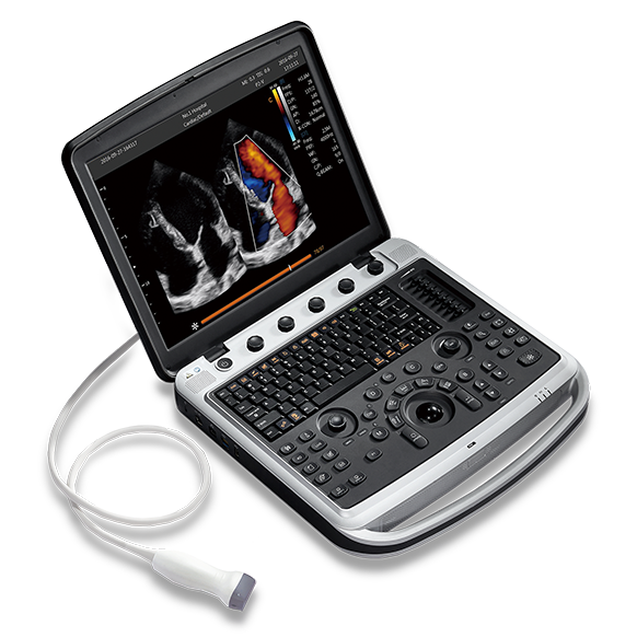 Ветеринарный УЗИ-аппарат CHISON SonoTouch 80 EXP Sonobook 9