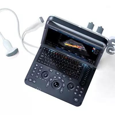 УЗИ аппарат Chison SonoTouch 60 OB