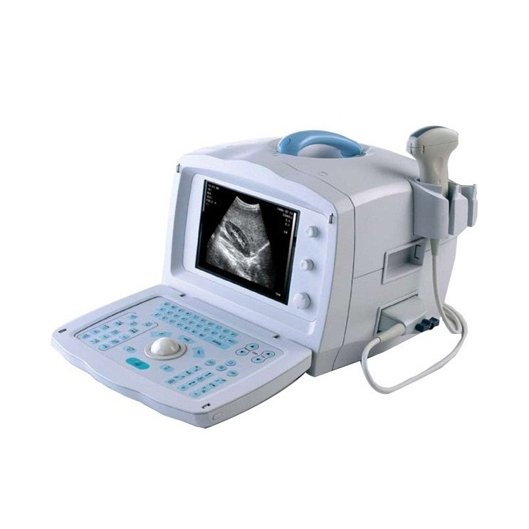 УЗИ аппарат Mindray DP 1100