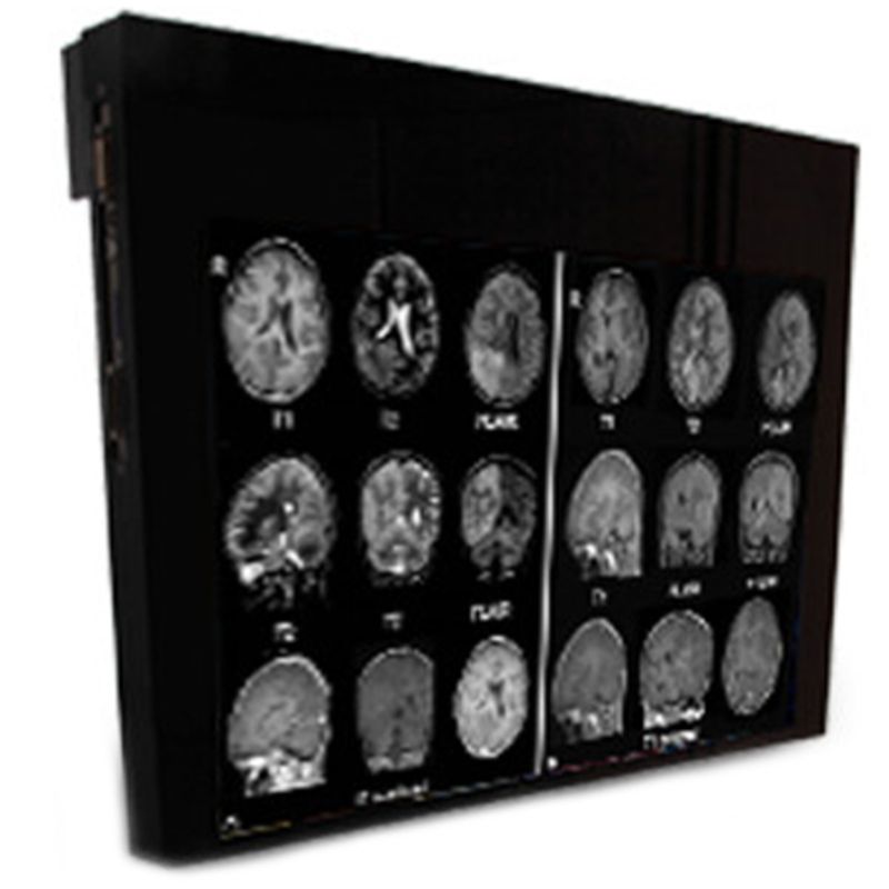 Медицинский монитор Double Black Imaging 24″ MRSafe Display
