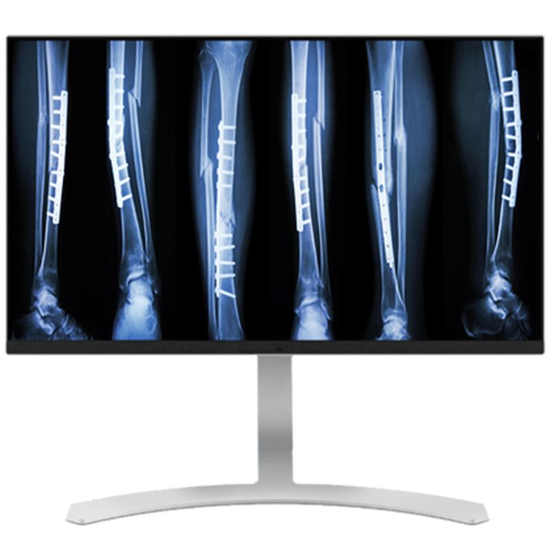 Медицинский монитор Double Black Imaging 27″ 8MP Color Clinical LED