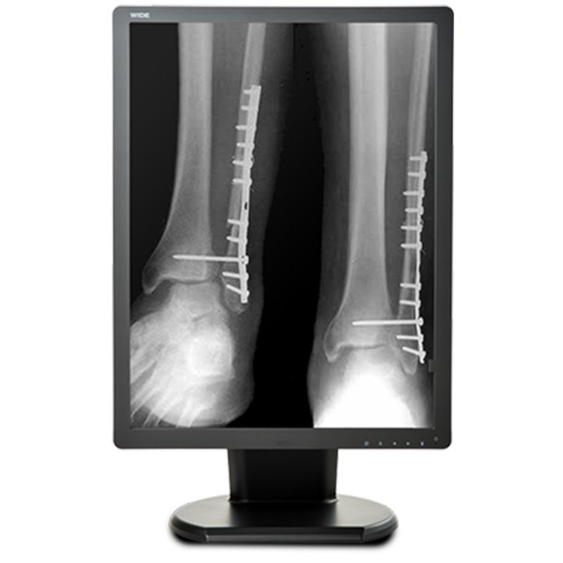 Медицинский монитор Double Black Imaging 2MP Monochrome