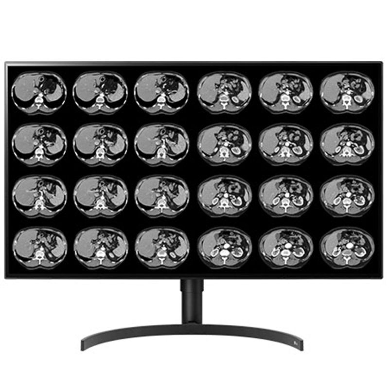 Медицинский монитор Double Black Imaging 32″ Color 8MP Large Format Display