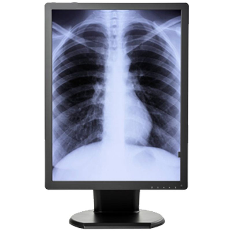 Медицинский монитор Double Black Imaging 3MP Monochrome Diagnostic Display
