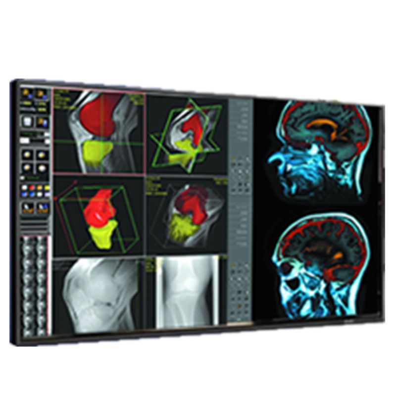 Медицинский монитор Double Black Imaging 42″ Professional LCD