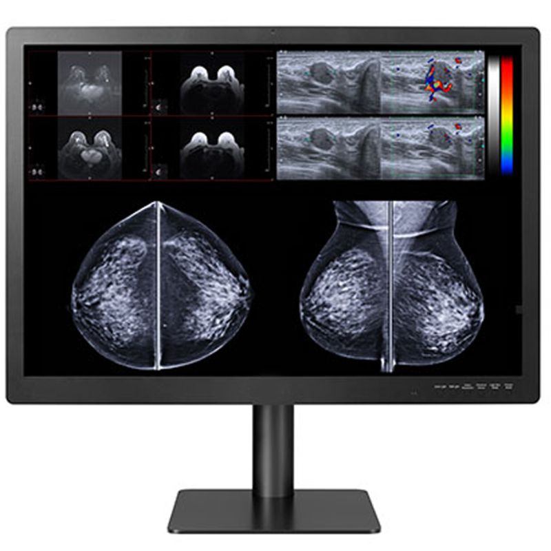 Медицинский монитор Double Black Imaging Gemini Series 12 MP Large Format Display