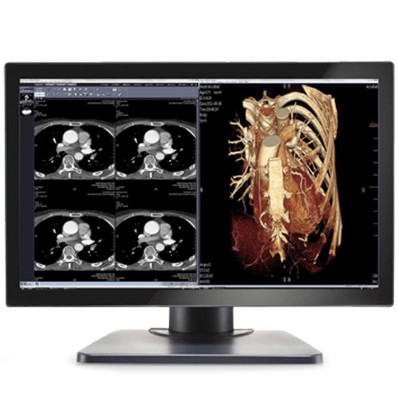 Медицинский монитор Double Black Imaging Image Systems Gemini 4MP Large Format Display
