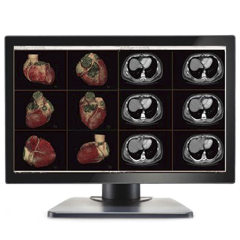 Медицинский монитор Double Black Imaging Image Systems Gemini 6MP Large Format Display