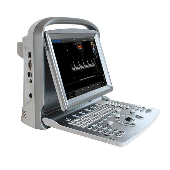 Ветеринарный УЗИ аппарат CHISON SonoTouch 20 (ECO 5)