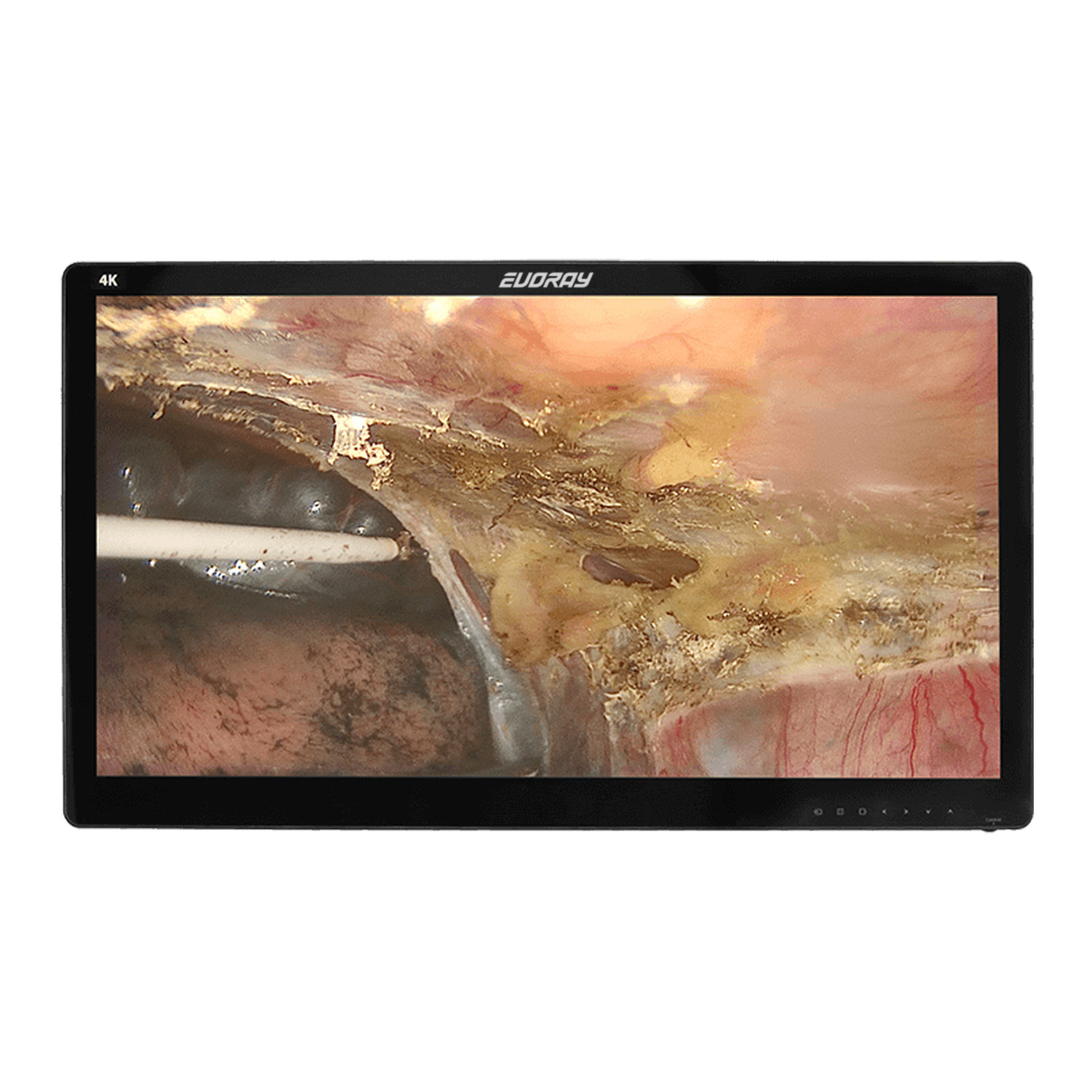 Монитор 32 4K эндоскопический-хирургический EVORAY S3281P