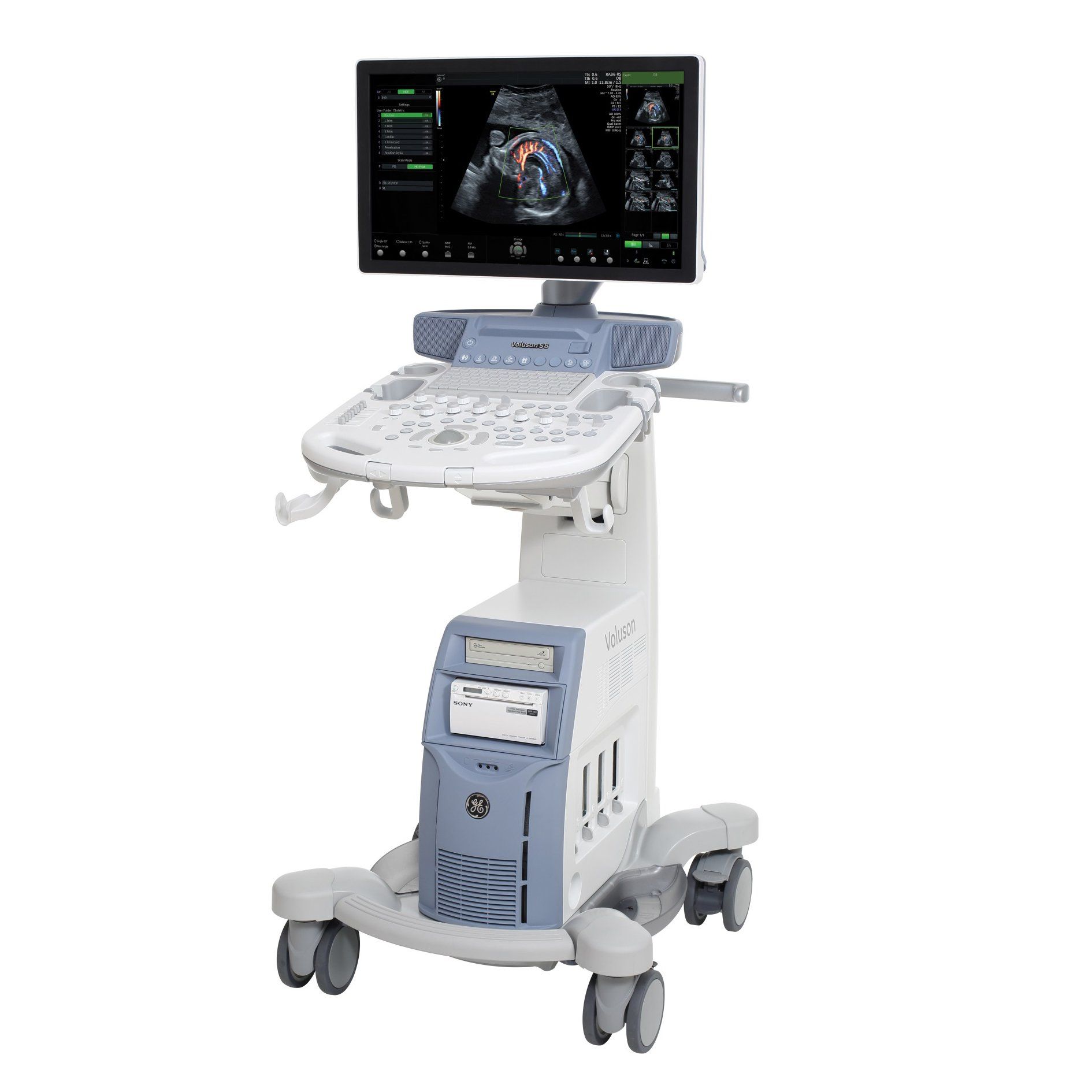 УЗИ аппарат GE Healthcare Voluson S8