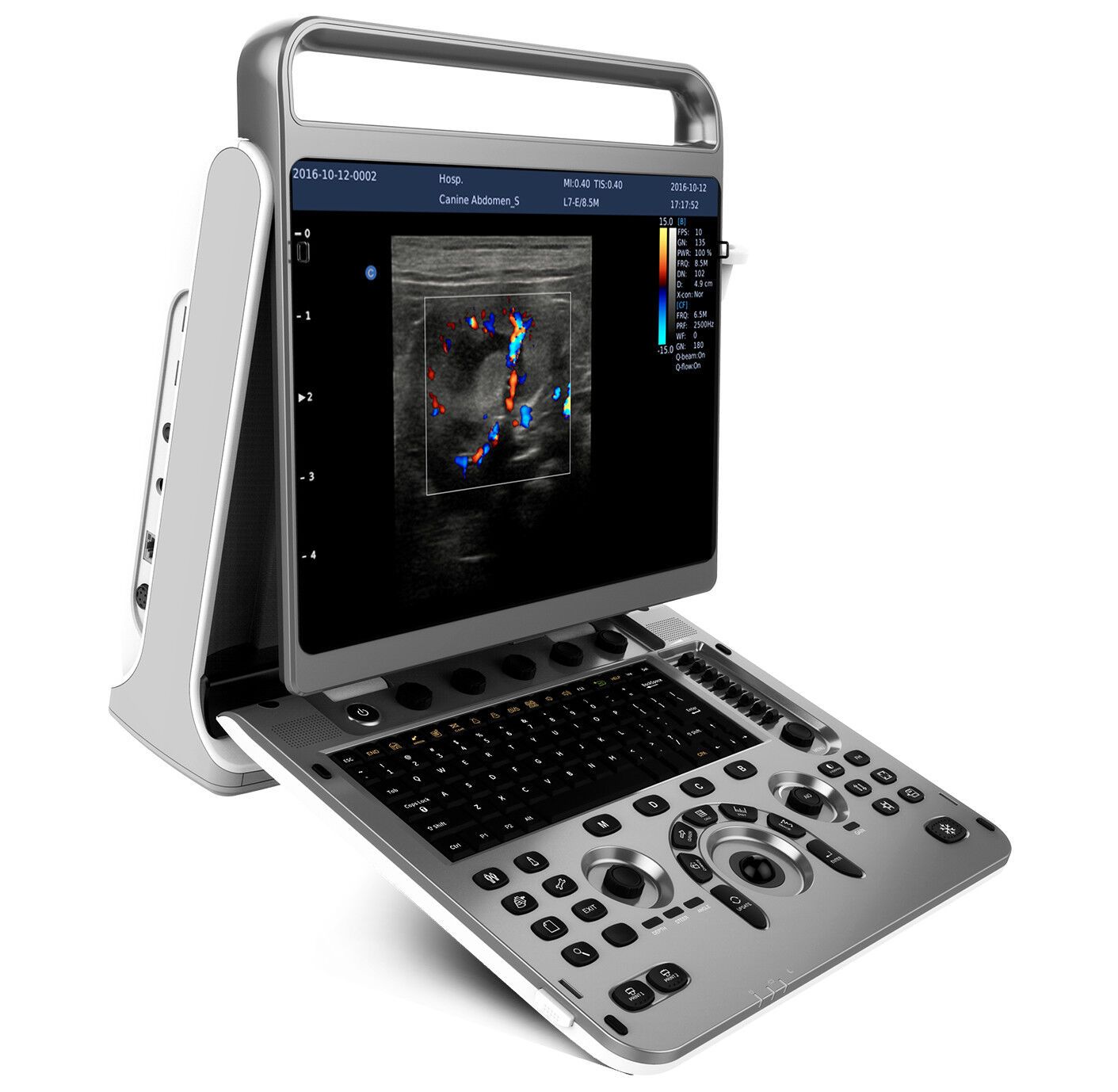 УЗИ аппарат Chison SonoTouch 60 OB