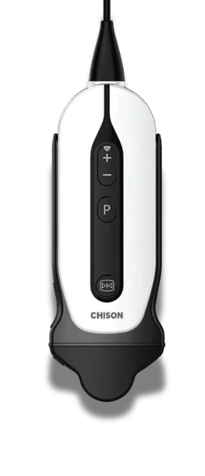 Ультракомпактный УЗИ сканер SonoEye P6 vet