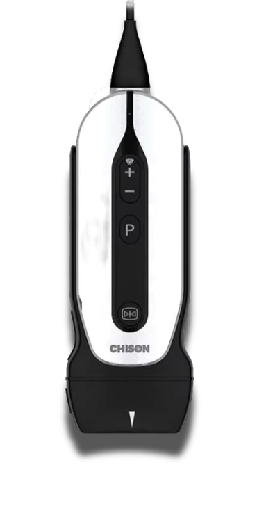 Ультракомпактный УЗИ сканер SonoEye P2 vet