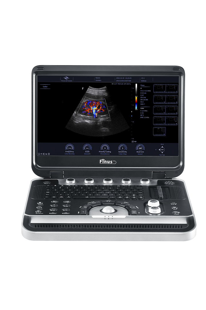 Портативная ультразвуковая система F&F Finus 50 VET