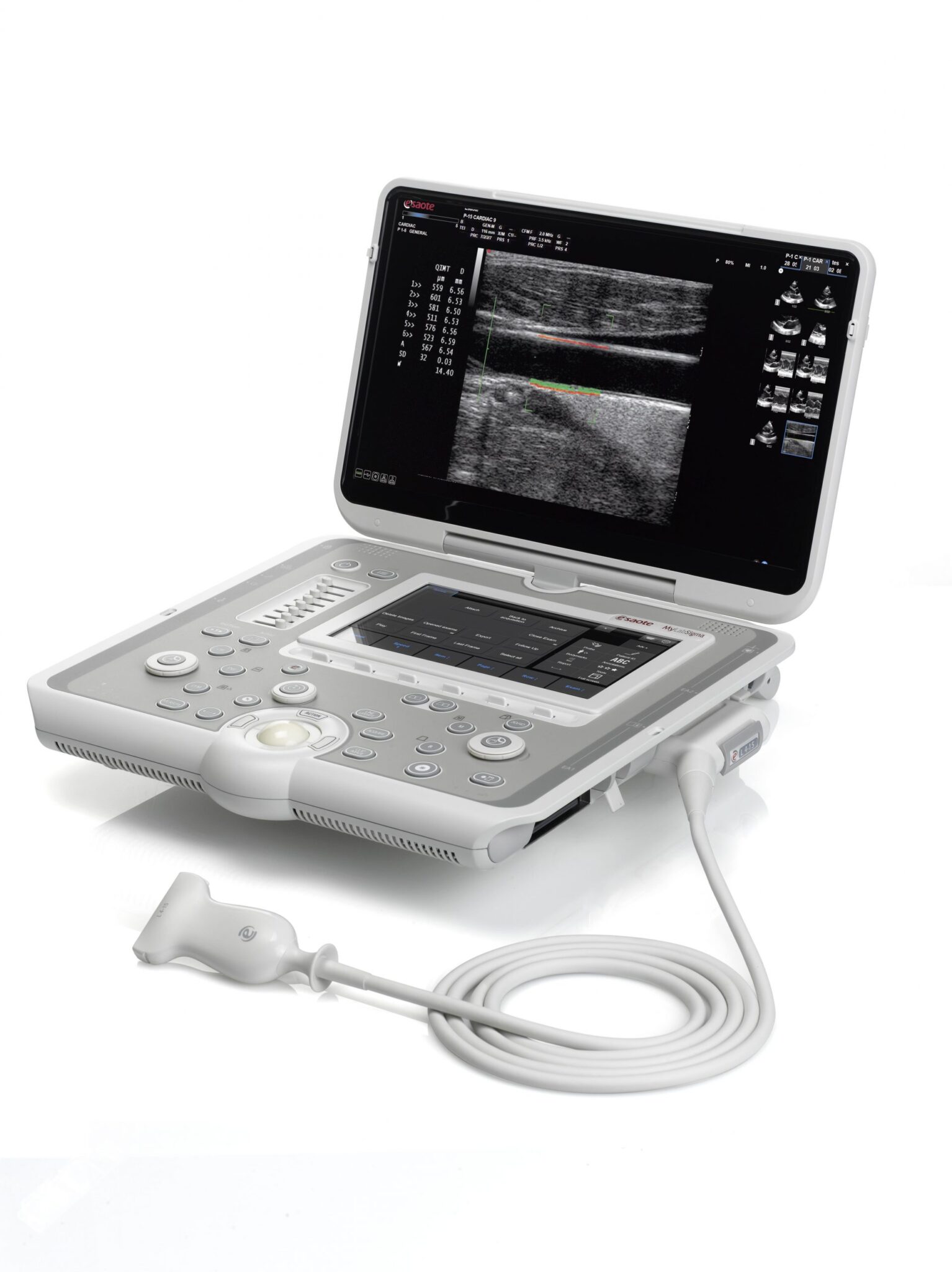 Портативная ультразвуковая система Esaote MyLab Sigma