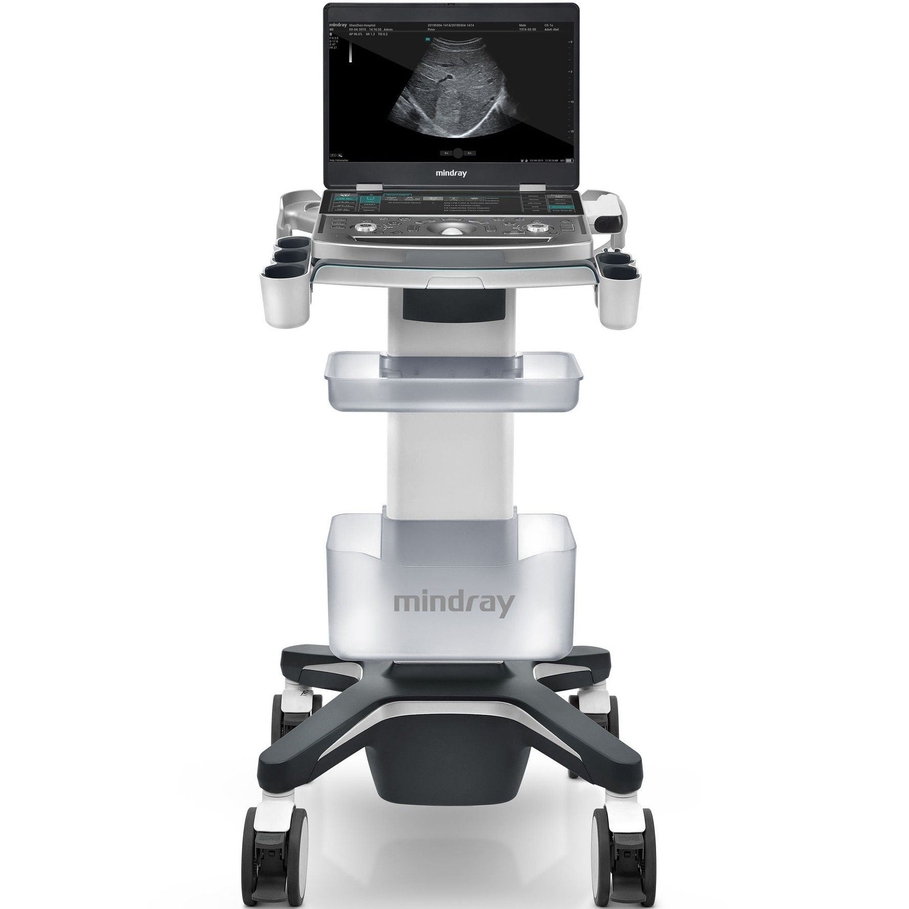 УЗИ аппарат Mindray MX7 Exp