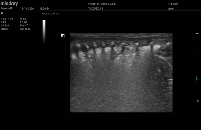 УЗИ аппарат Mindray Resona i9 Exp