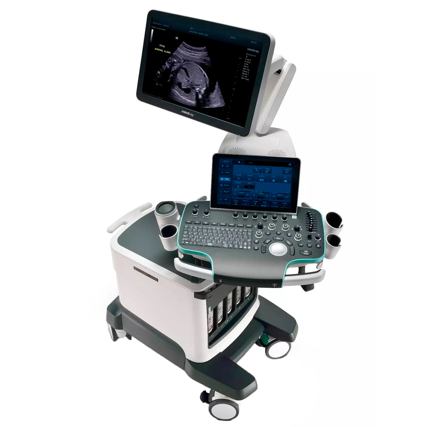 УЗИ аппарат Mindray Resona 6