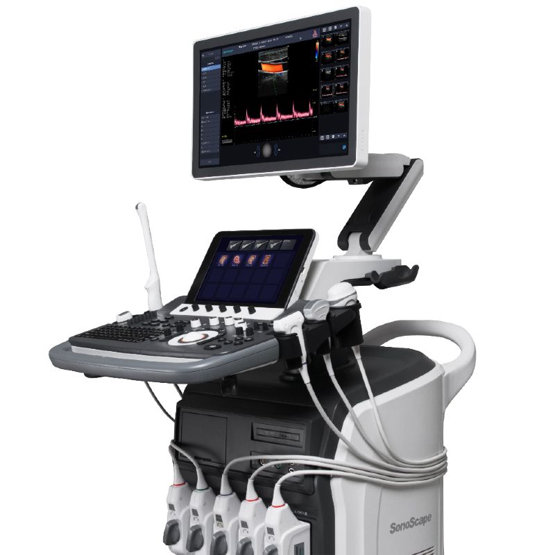 УЗИ аппарат Sonoscape S40