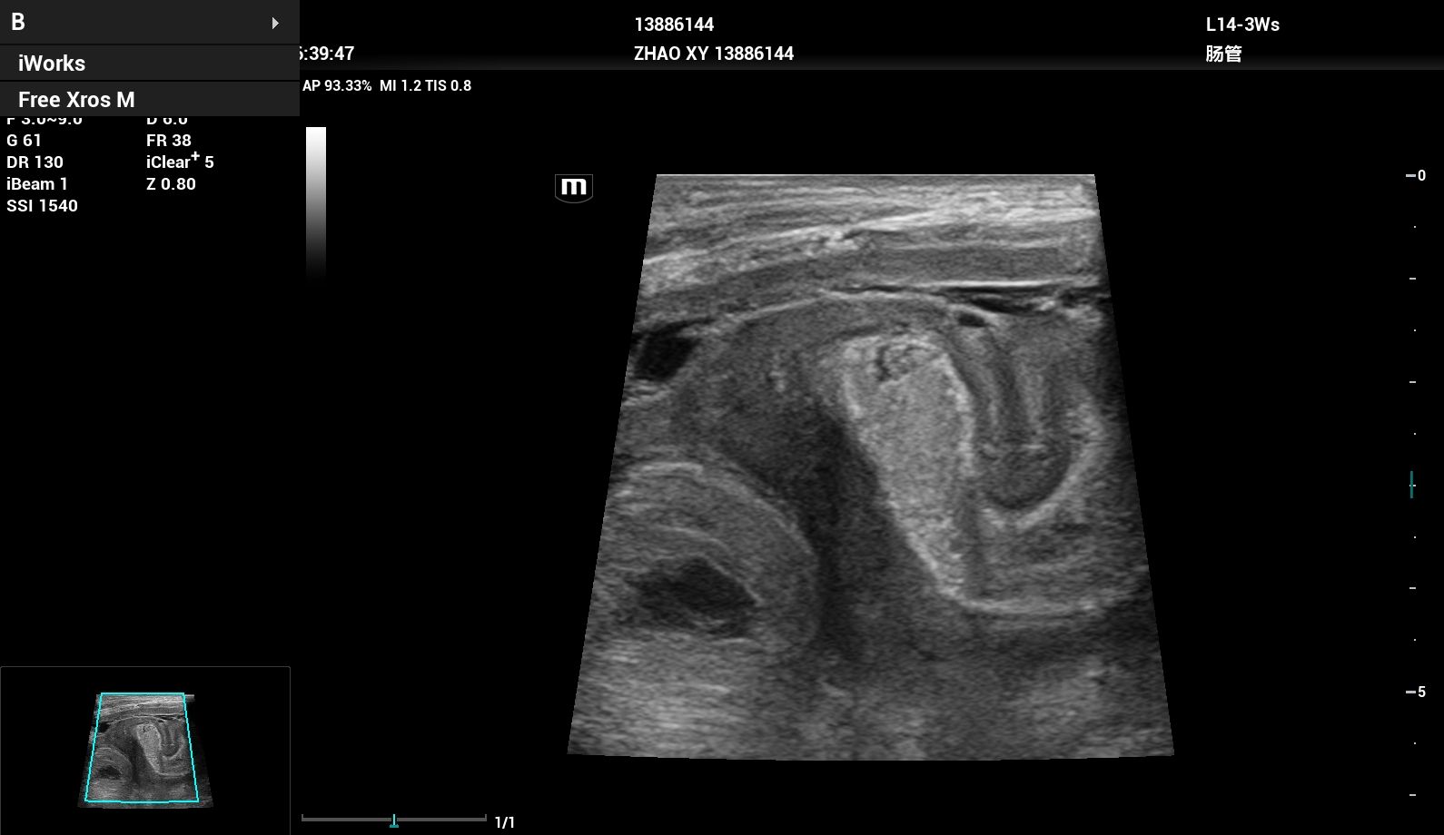 УЗИ аппарат Mindray Resona i9 Exp