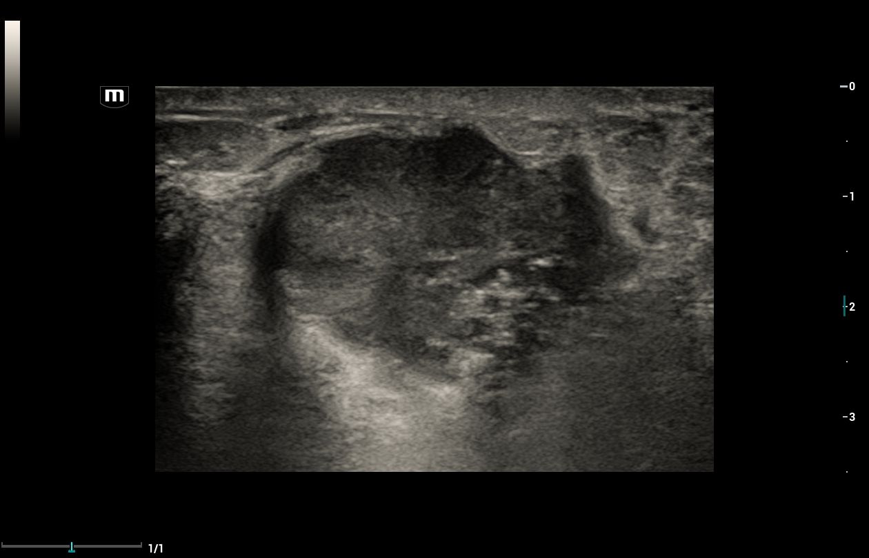 УЗИ аппарат Mindray Resona i9 Exp